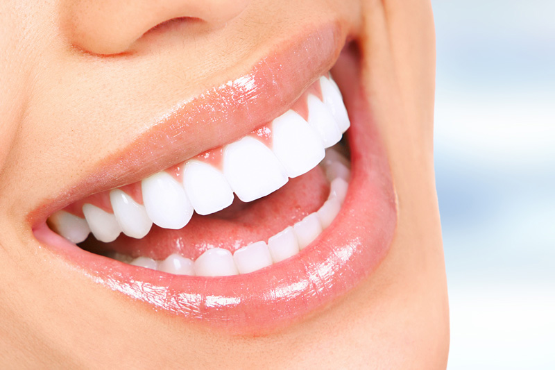 Cosmetic Dentistry in Keller